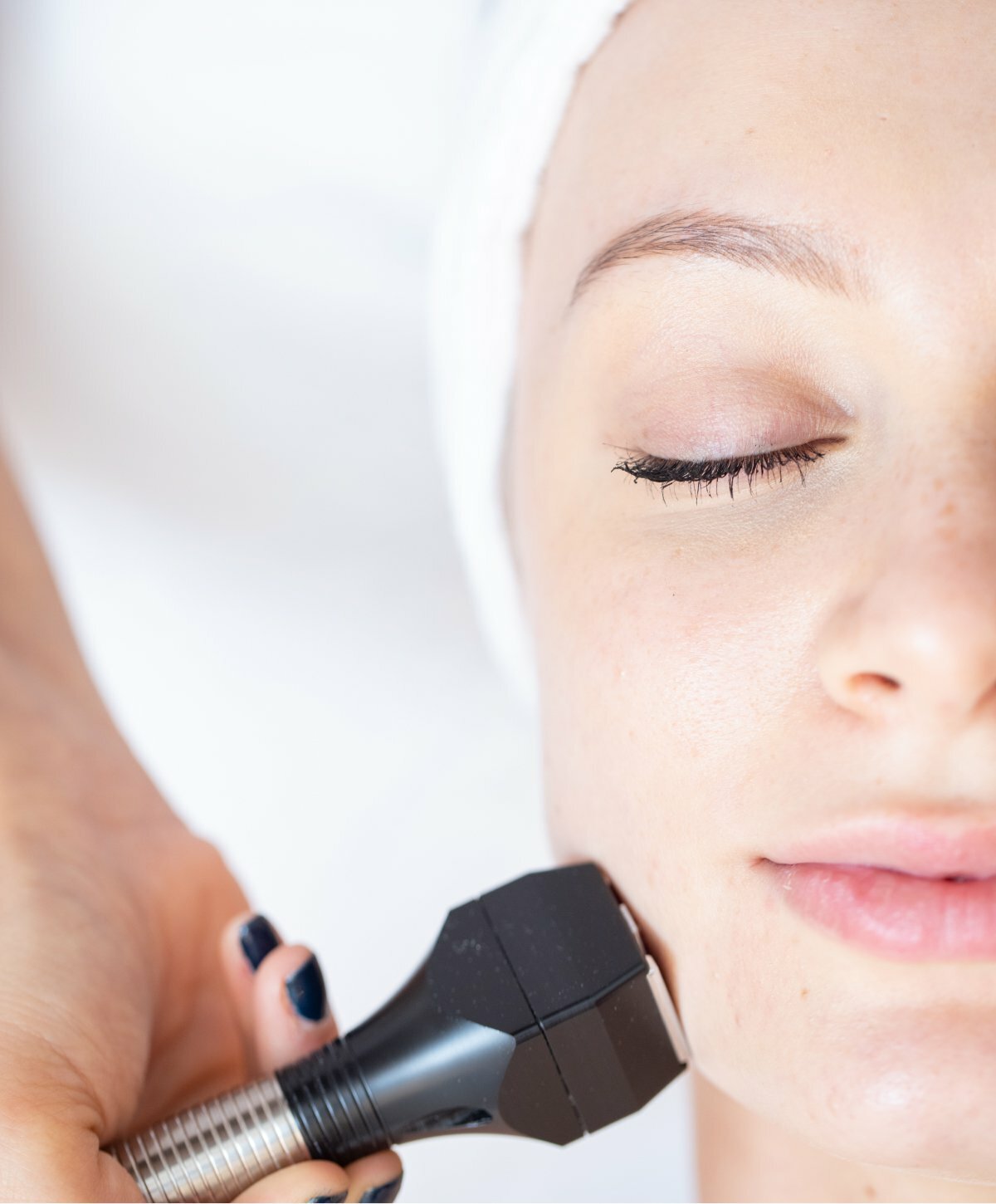 New York City Skin Texture Treatment model with brown hair